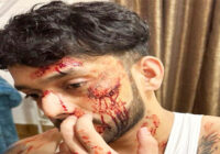 Actor Shailesh Ramugade Gears Up for Bollywood Debut, Shares Unrecognisable Blood-Soaked Look