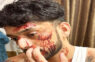 Actor Shailesh Ramugade Gears Up for Bollywood Debut, Shares Unrecognisable Blood-Soaked Look